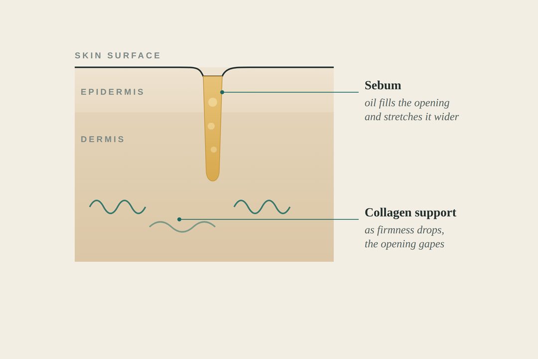 A clinical cross-section illustration of a skin pore in cream and teal, showing the follicle opening, sebum, and surrounding collagen scaffold