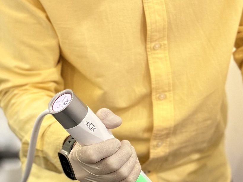 Dr Ong Jin Khang's gloved hand holding the XERF handpiece against gel-sheened skin, the device tip in contact, 32C reading visible on the unit