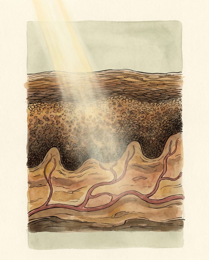 An ink and watercolour cross-section of darker skin, with a shaft of light entering from above into a dense pigmented layer and red vessels beneath