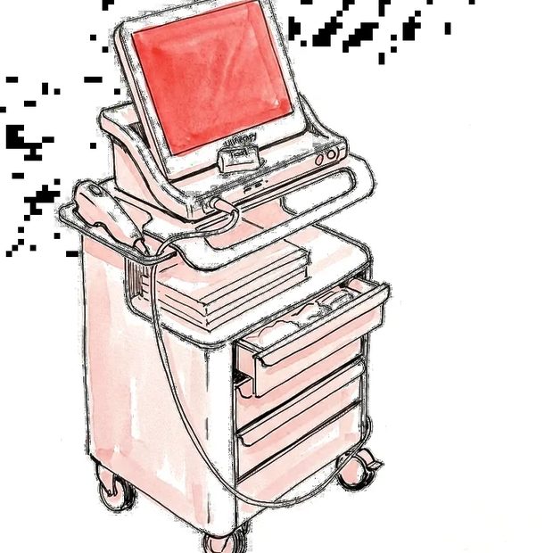 A hand-drawn sketch of the Ultherapy console in the clinic